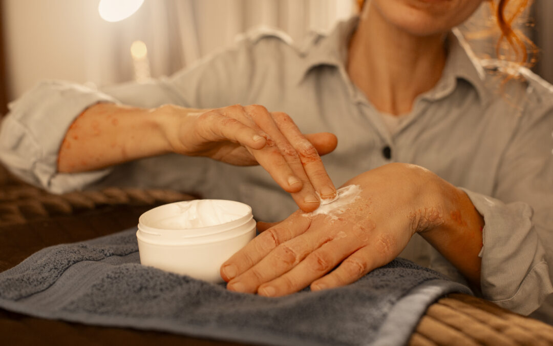 Top Creams for Nerve Pain: What Works, How They Help, and What to Look For