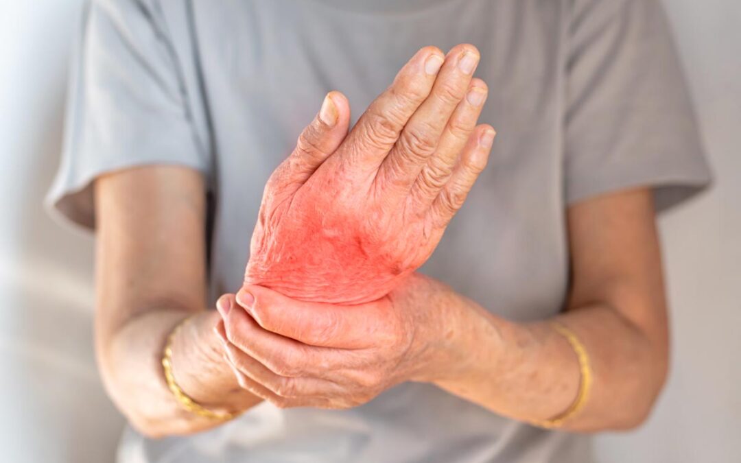 Ensayos Clínicos para la Artritis: Qué Son, Cómo Funcionan y Cómo Participar