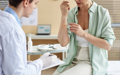 Ensayos Clínicos de Psoriasis: Avances en el Tratamiento y Mejora de la Calidad de Vida