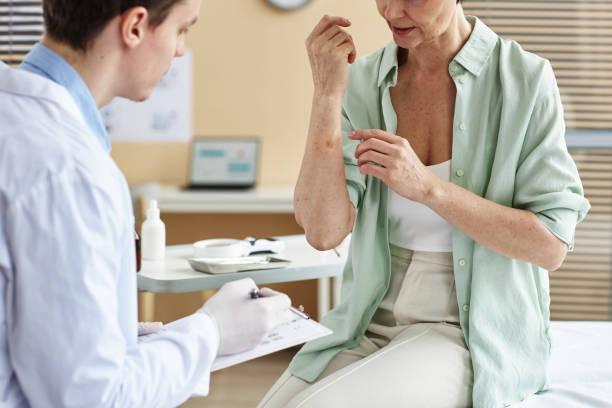 Ensayos Clínicos de Psoriasis: Avances en el Tratamiento y Mejora de la Calidad de Vida