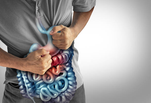 Ensayos Clínicos de la Enfermedad de Crohn: Avances en Tratamiento y Esperanza