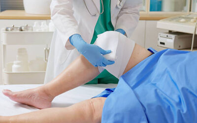 Knee Replacement Surgery: What to Know Before Taking the Next Step